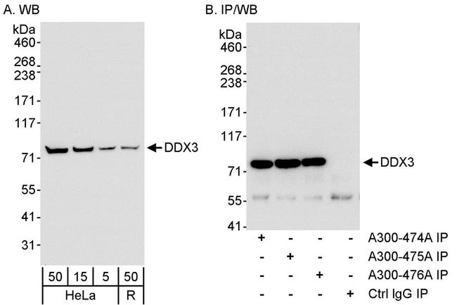 DDX3 Antibody in Western Blot (WB)