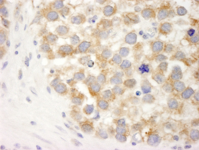 DDX3 Antibody in Immunohistochemistry (IHC)