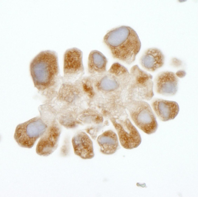 DDX3 Antibody in Immunohistochemistry (IHC)