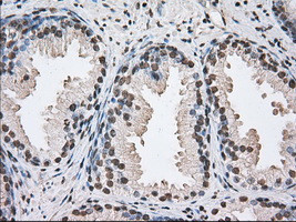 DDX39B Antibody in Immunohistochemistry (Paraffin) (IHC (P))