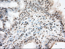 DDX39B Antibody in Immunohistochemistry (Paraffin) (IHC (P))