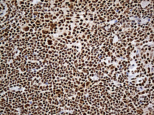 DDX39B Antibody in Immunohistochemistry (Paraffin) (IHC (P))