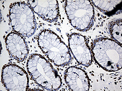 DDX39B Antibody in Immunohistochemistry (Paraffin) (IHC (P))