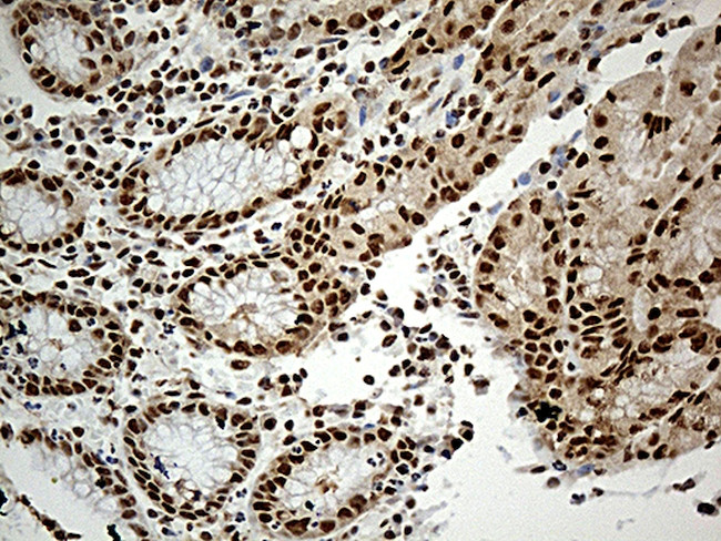 DDX39B Antibody in Immunohistochemistry (Paraffin) (IHC (P))