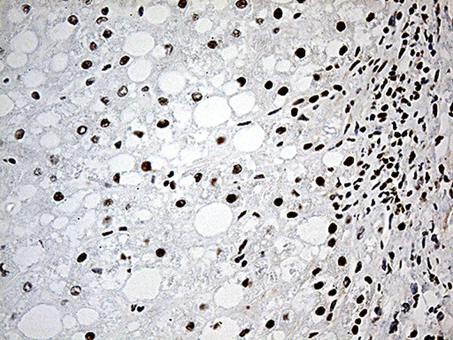 DDX39B Antibody in Immunohistochemistry (Paraffin) (IHC (P))