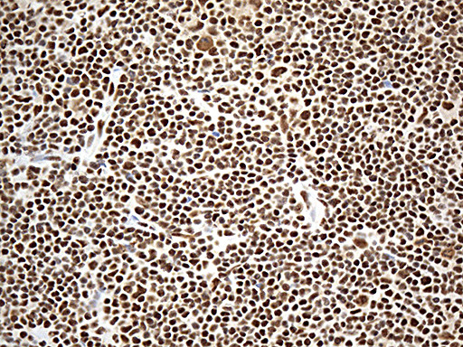 DDX39B Antibody in Immunohistochemistry (Paraffin) (IHC (P))