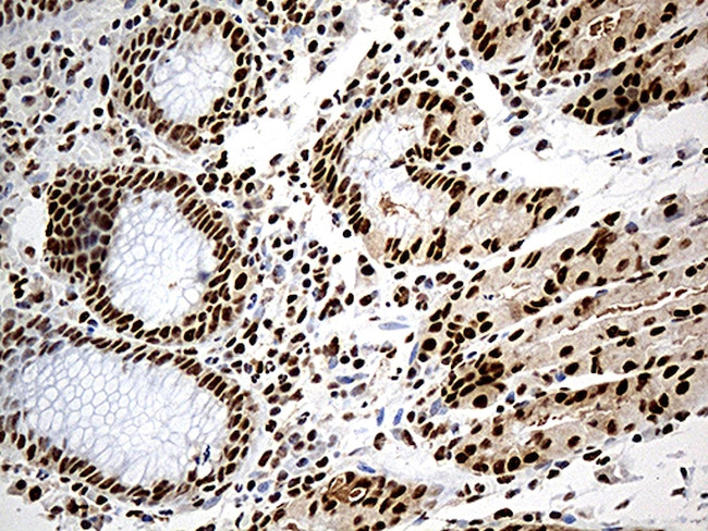 DDX39B Antibody in Immunohistochemistry (Paraffin) (IHC (P))