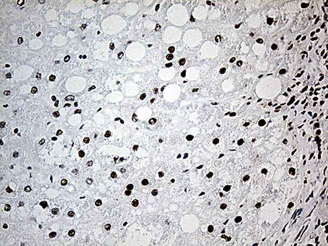 DDX39B Antibody in Immunohistochemistry (Paraffin) (IHC (P))