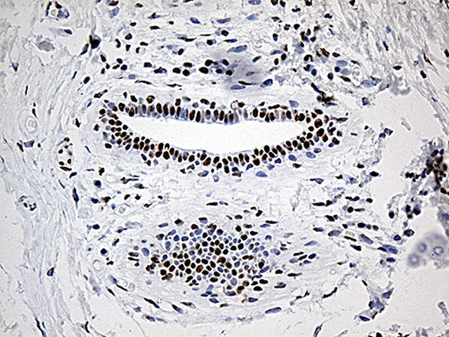 DDX39B Antibody in Immunohistochemistry (Paraffin) (IHC (P))