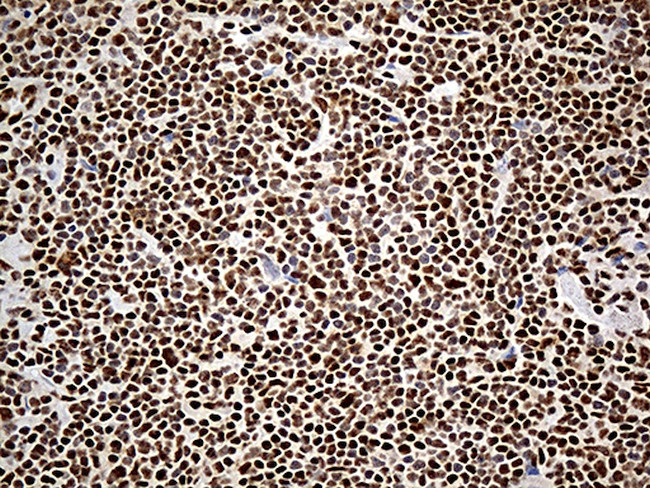 DDX39B Antibody in Immunohistochemistry (Paraffin) (IHC (P))