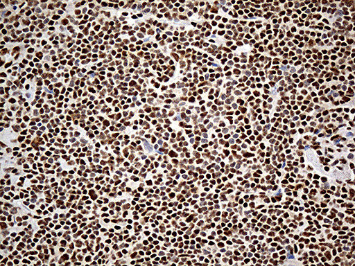 DDX39B Antibody in Immunohistochemistry (Paraffin) (IHC (P))