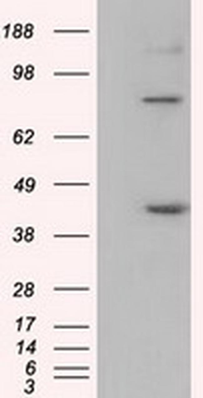 DDX39B Antibody in Western Blot (WB)