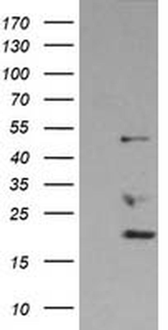 DDX39B Antibody in Western Blot (WB)