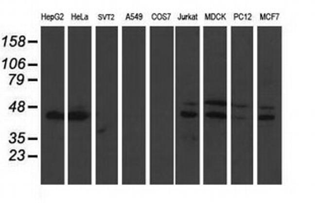 DDX39B Antibody in Western Blot (WB)