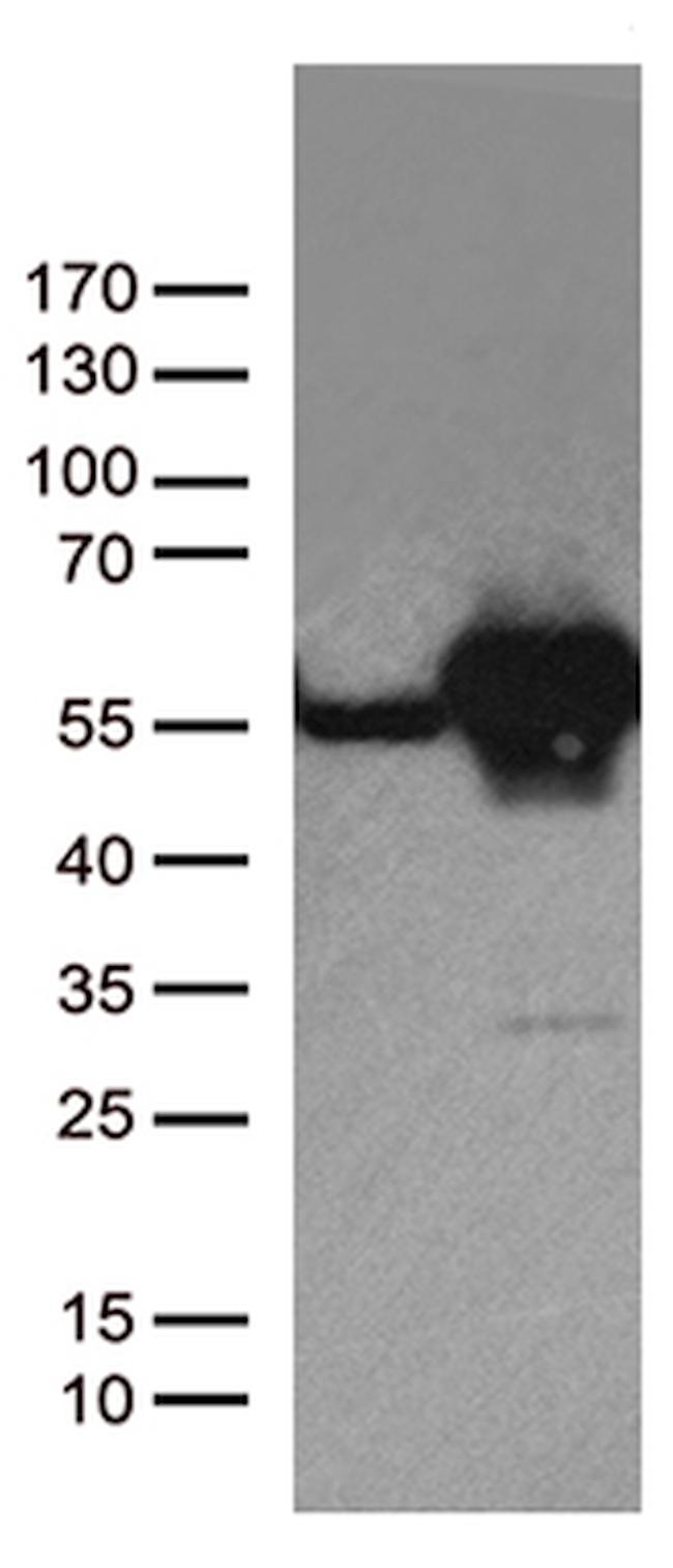 DDX39B Antibody in Western Blot (WB)