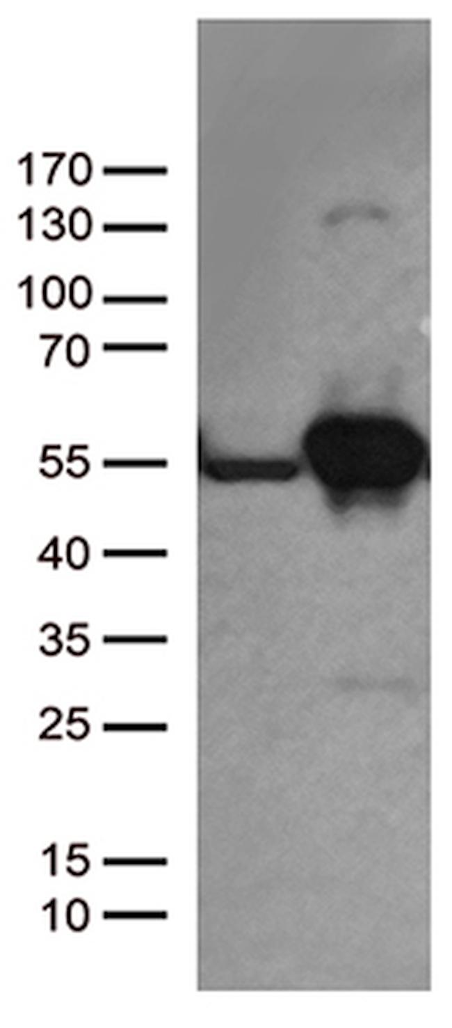 DDX39B Antibody in Western Blot (WB)