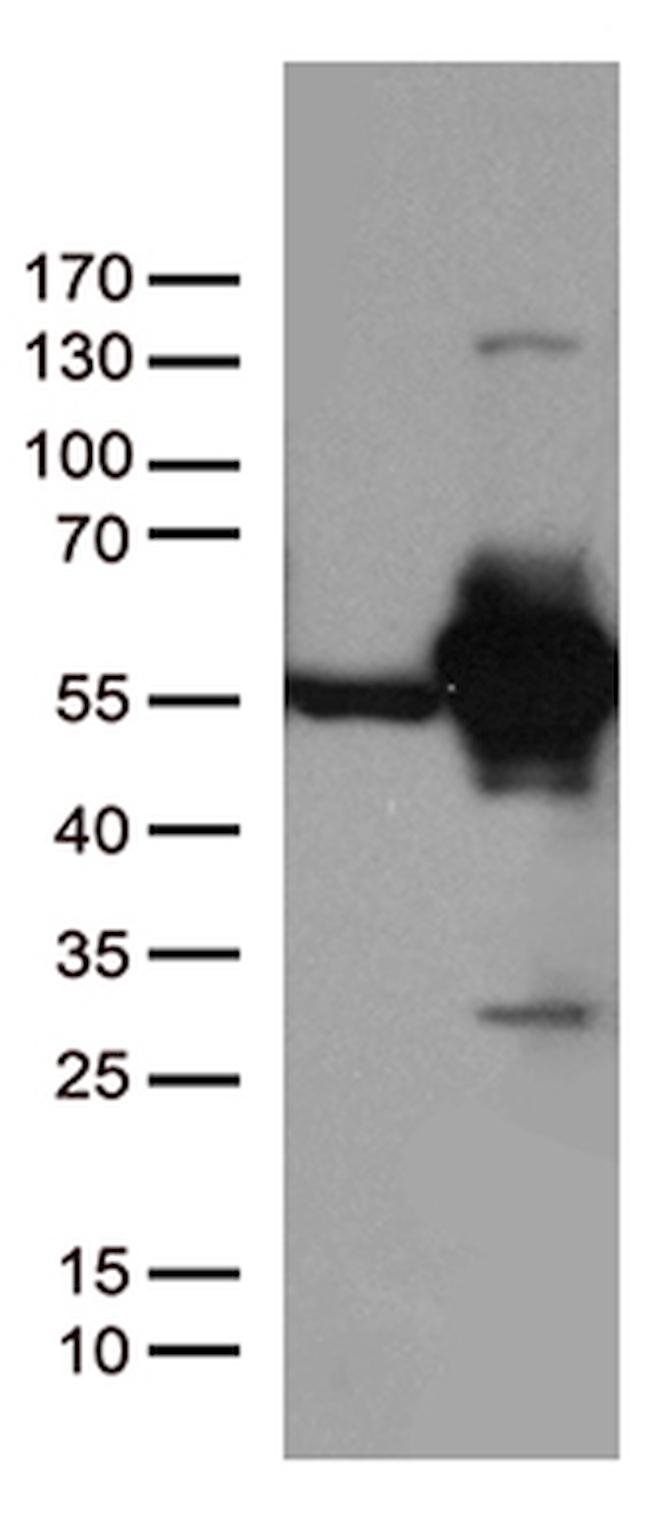 DDX39B Antibody in Western Blot (WB)