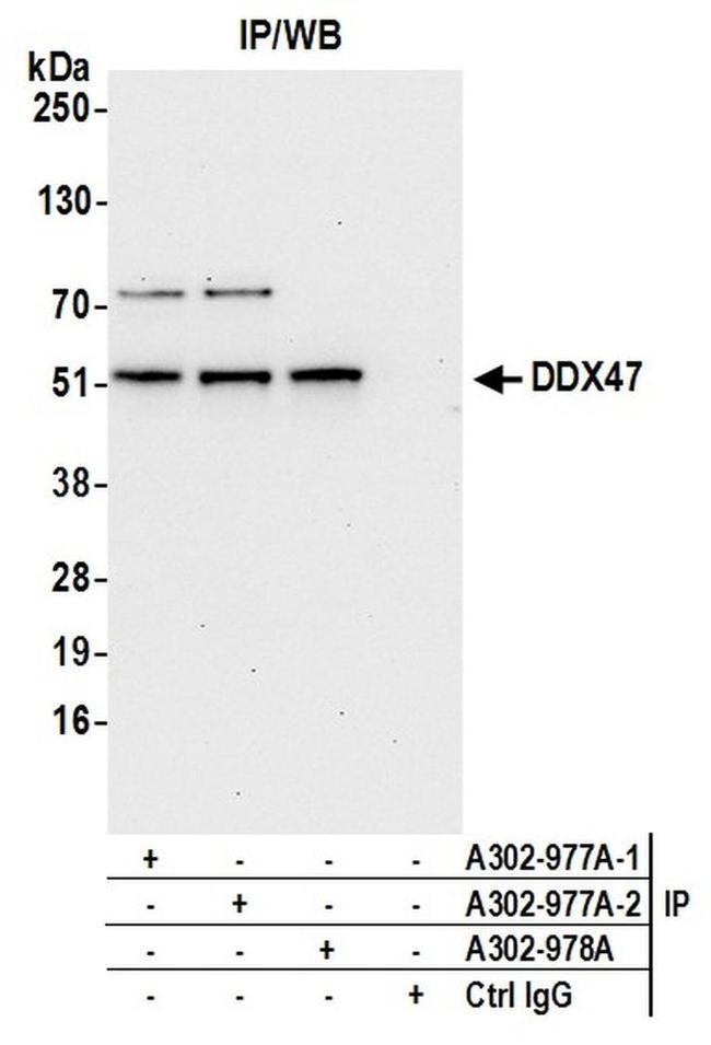 DDX47 Antibody in Western Blot (WB)