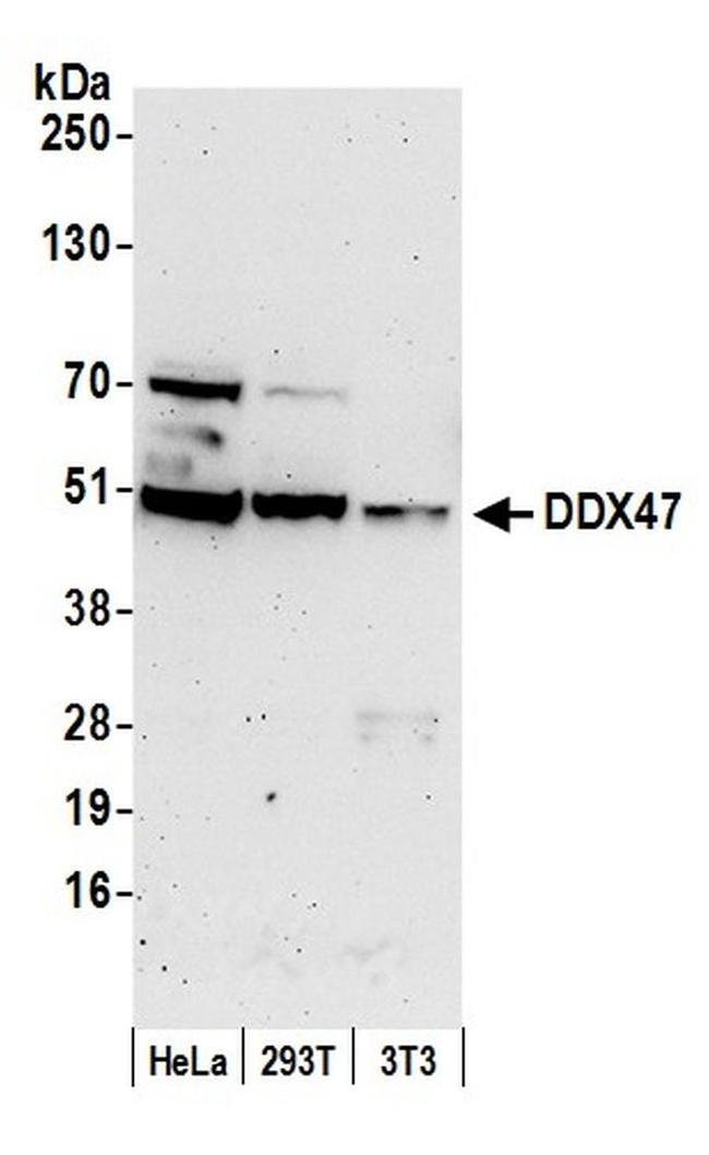 DDX47 Antibody in Western Blot (WB)