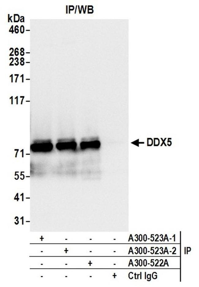 DDX5 Antibody in Western Blot (WB)