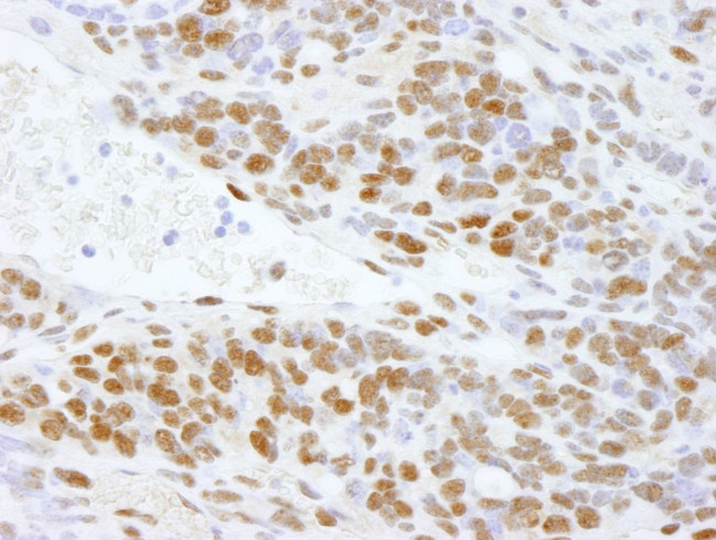 DDX5 Antibody in Immunohistochemistry (IHC)