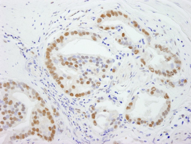 DDX5 Antibody in Immunohistochemistry (IHC)