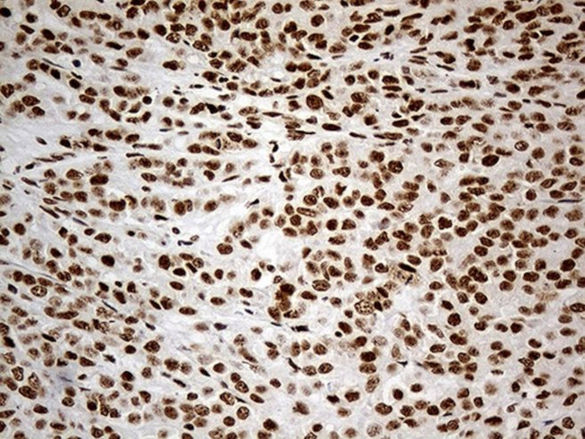 DDX50 Antibody in Immunohistochemistry (Paraffin) (IHC (P))