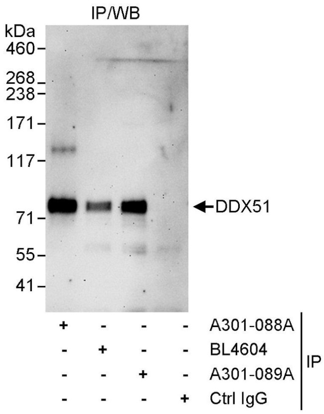 DDX51 Antibody in Immunoprecipitation (IP)