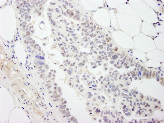 DDX54 Antibody in Immunohistochemistry (IHC)