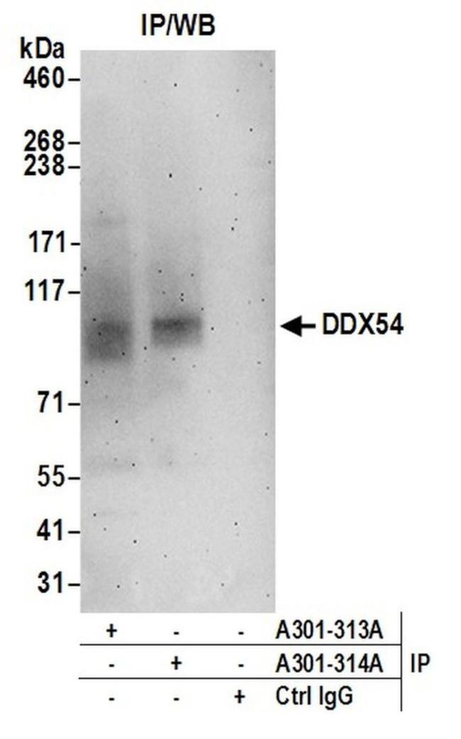 DDX54 Antibody in Immunoprecipitation (IP)