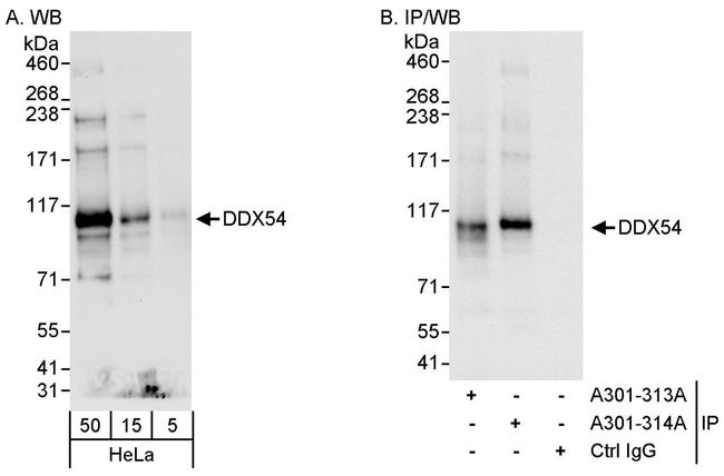 DDX54 Antibody in Western Blot (WB)