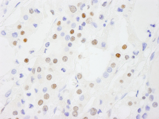 DDX54 Antibody in Immunohistochemistry (IHC)