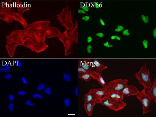 DDX56 Antibody in Immunocytochemistry (ICC/IF)