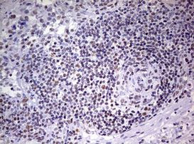 DDX56 Antibody in Immunohistochemistry (Paraffin) (IHC (P))