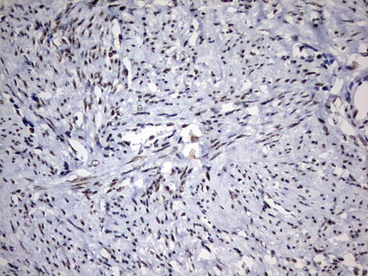 DDX56 Antibody in Immunohistochemistry (Paraffin) (IHC (P))