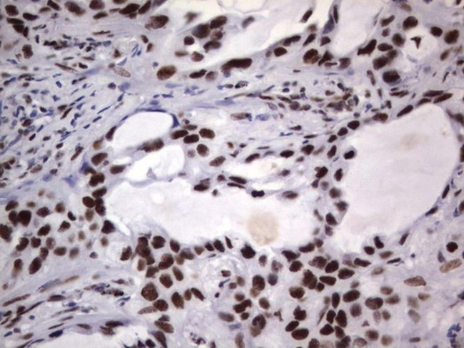 DDX56 Antibody in Immunohistochemistry (Paraffin) (IHC (P))