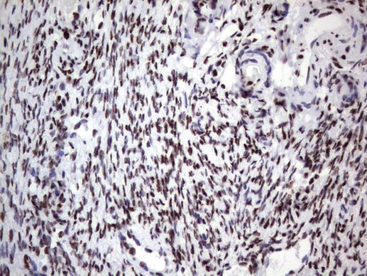 DDX56 Antibody in Immunohistochemistry (Paraffin) (IHC (P))