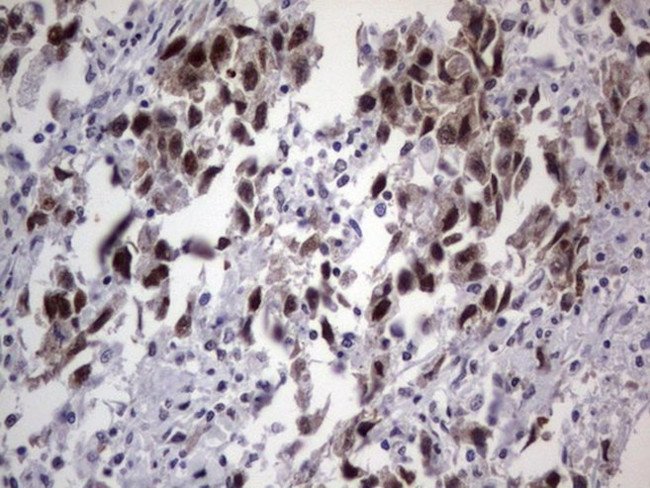 DDX56 Antibody in Immunohistochemistry (Paraffin) (IHC (P))