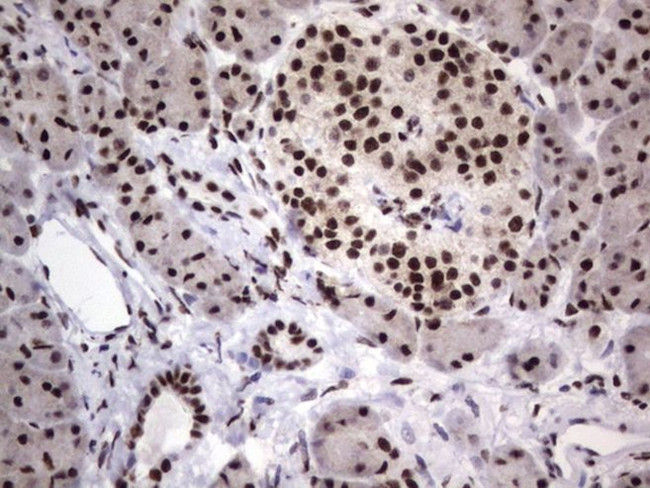 DDX56 Antibody in Immunohistochemistry (Paraffin) (IHC (P))