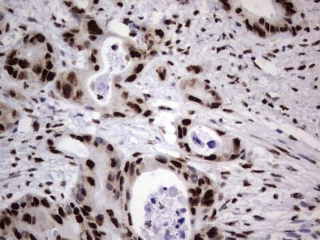 DDX56 Antibody in Immunohistochemistry (Paraffin) (IHC (P))