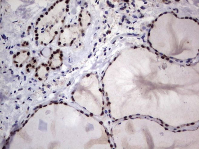 DDX56 Antibody in Immunohistochemistry (Paraffin) (IHC (P))