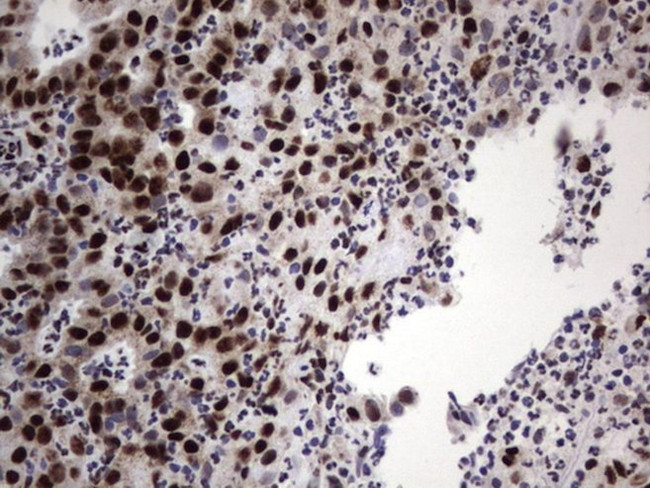 DDX56 Antibody in Immunohistochemistry (Paraffin) (IHC (P))