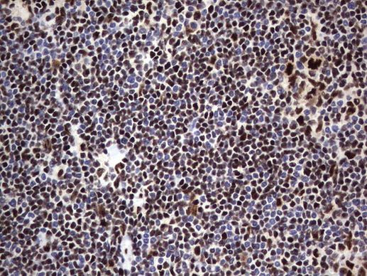 DDX56 Antibody in Immunohistochemistry (Paraffin) (IHC (P))