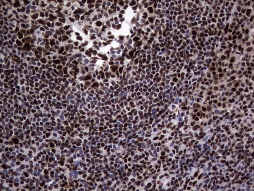 DDX56 Antibody in Immunohistochemistry (Paraffin) (IHC (P))