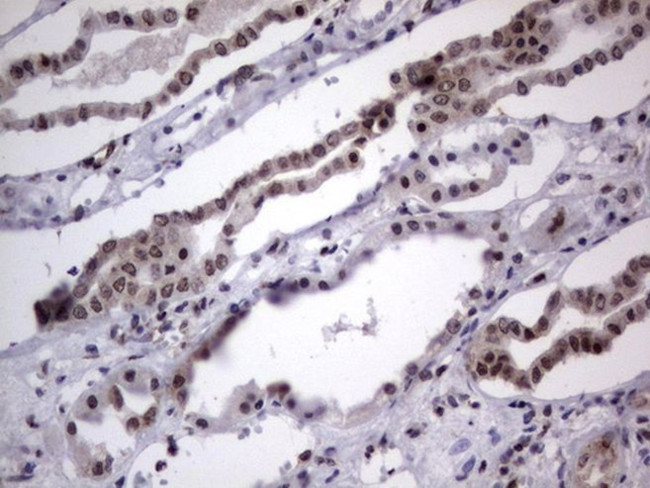 DDX56 Antibody in Immunohistochemistry (Paraffin) (IHC (P))