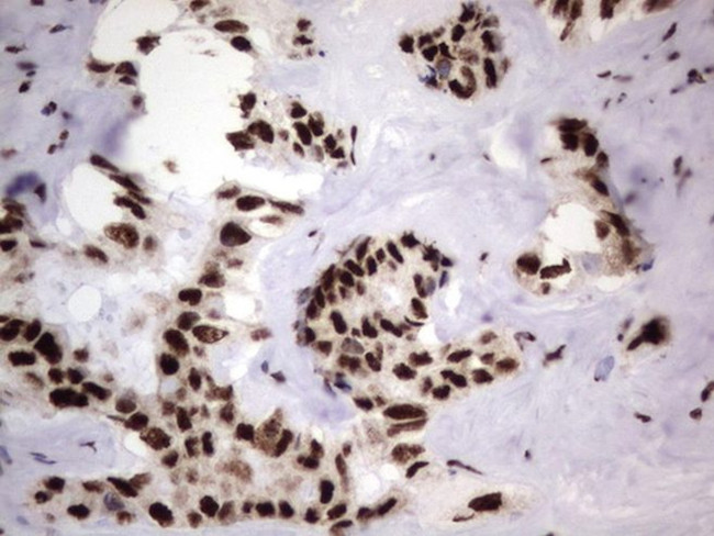 DDX56 Antibody in Immunohistochemistry (Paraffin) (IHC (P))