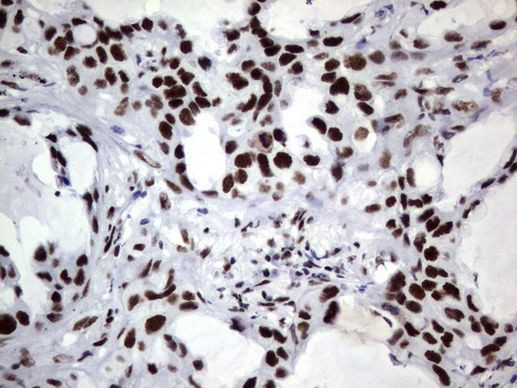 DDX56 Antibody in Immunohistochemistry (Paraffin) (IHC (P))