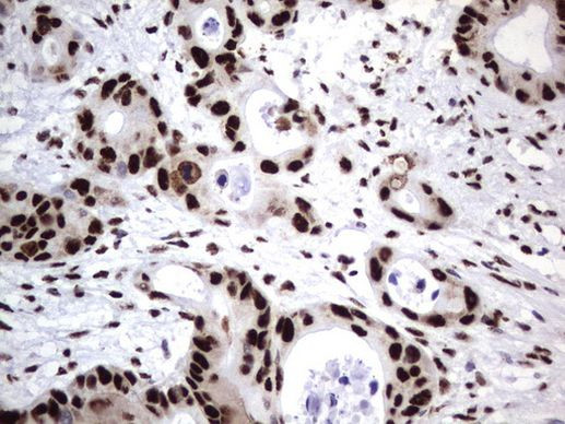 DDX56 Antibody in Immunohistochemistry (Paraffin) (IHC (P))