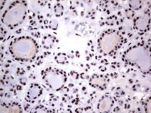 DDX56 Antibody in Immunohistochemistry (Paraffin) (IHC (P))