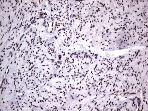 DDX56 Antibody in Immunohistochemistry (Paraffin) (IHC (P))